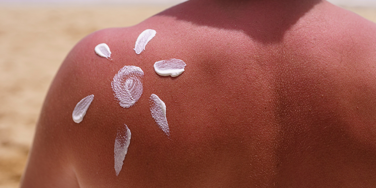 Imagem de protetor solar, que remete ao caso da marca de protetor solar Hawaiian Tropic, tratado pelo nosso sócio Rafael Lacaz no propmark.